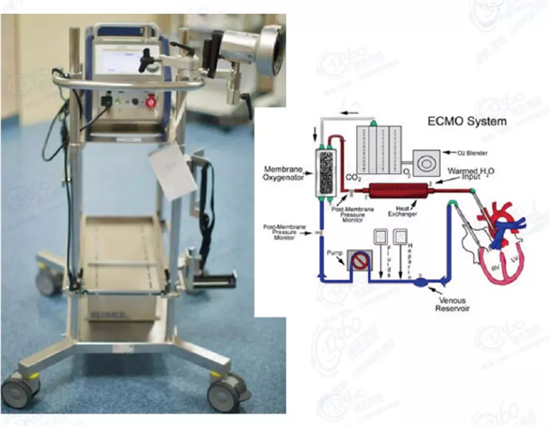 體外膜肺氧合(ECMO)設備 體外膜肺氧合(ECMO)設備